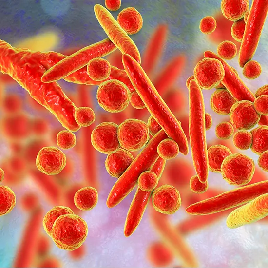 Mycoplasma Pneumonia